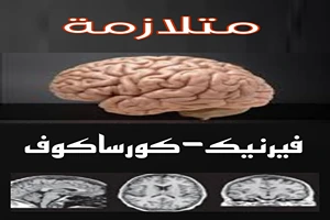 متلازمة فيرنيك-كورساكوف