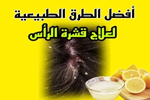 أفضل الطرق الطبيعية لعلاج قشرة الرأس