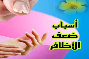 أسباب ضعف الأظافر